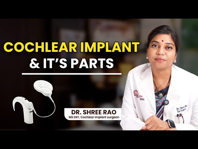 cochlear implant and its parts