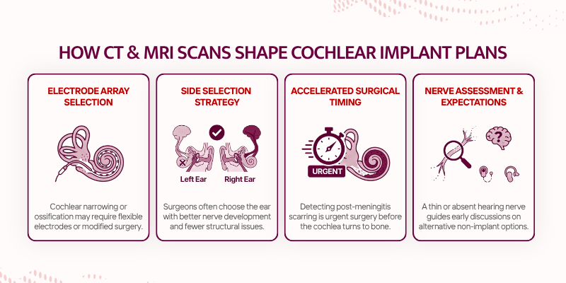 Cochlear Implant CT scan MRI - How CT & MRI Scans Shape Cochlear Implant Plans