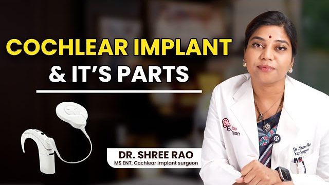 cochlear implant and its parts